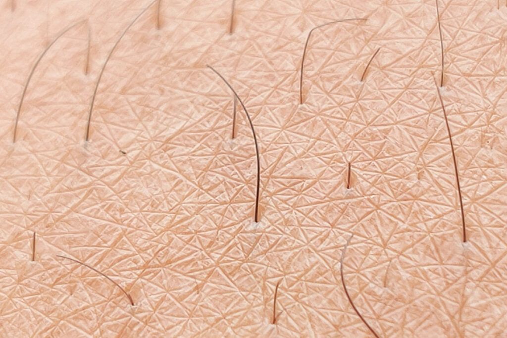 Close up of dark hair on skin