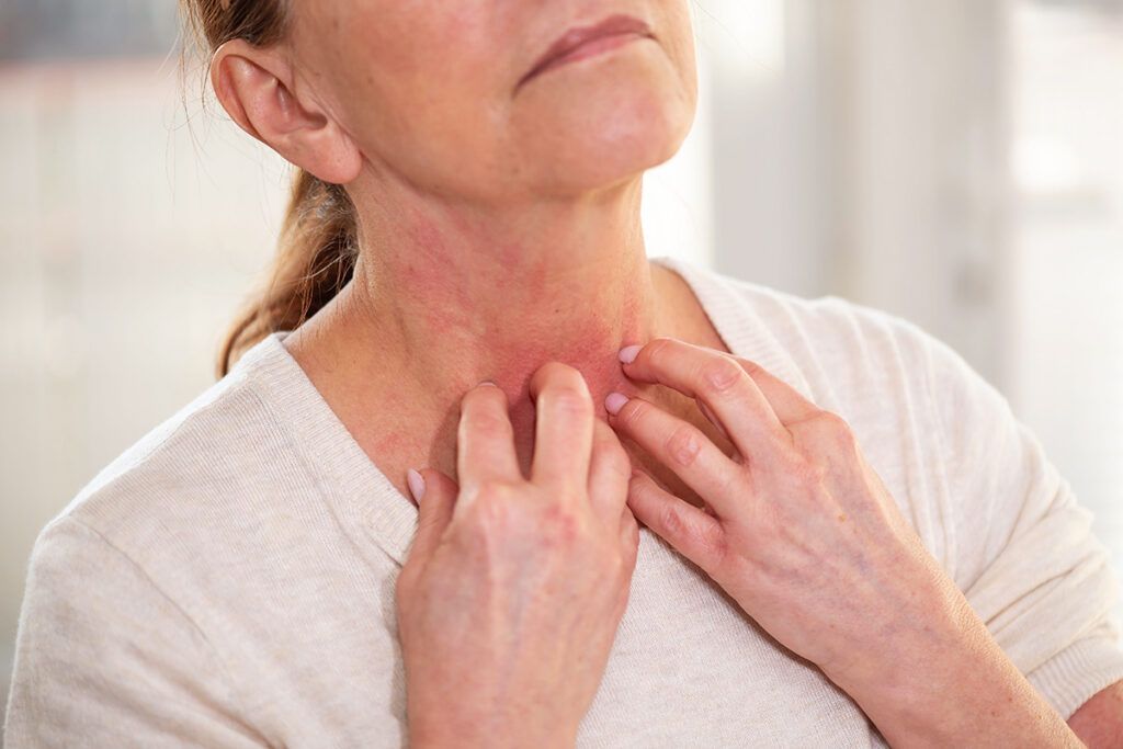 Person itching rash on throat