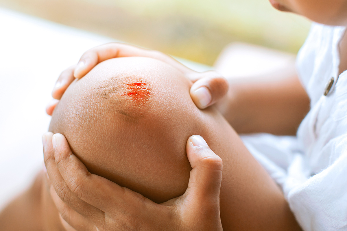 Scraped knee