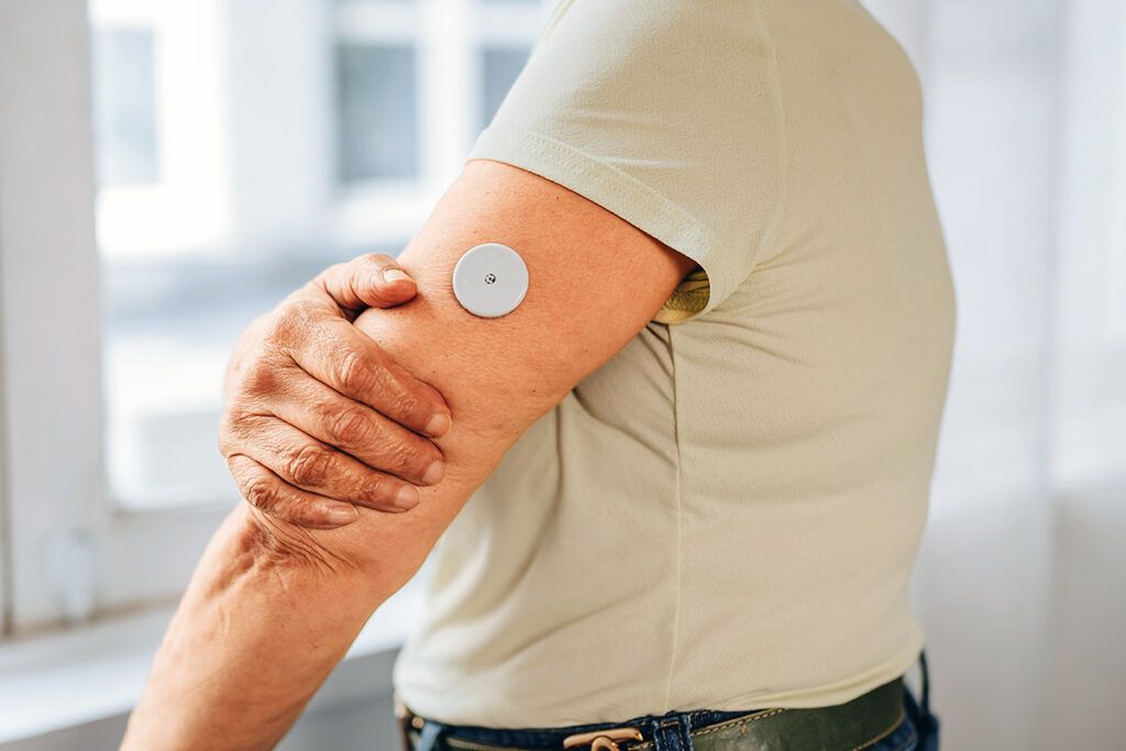 Glucose monitor in arm