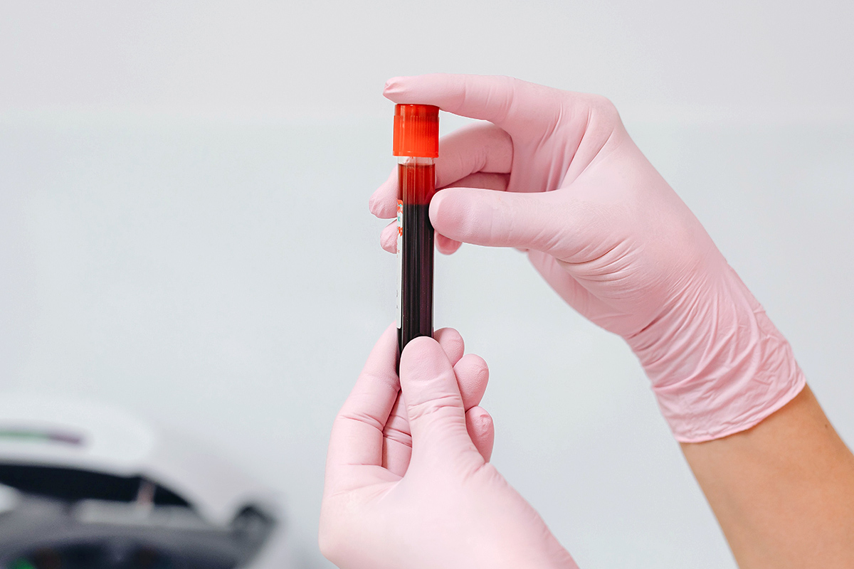 Vial of blood