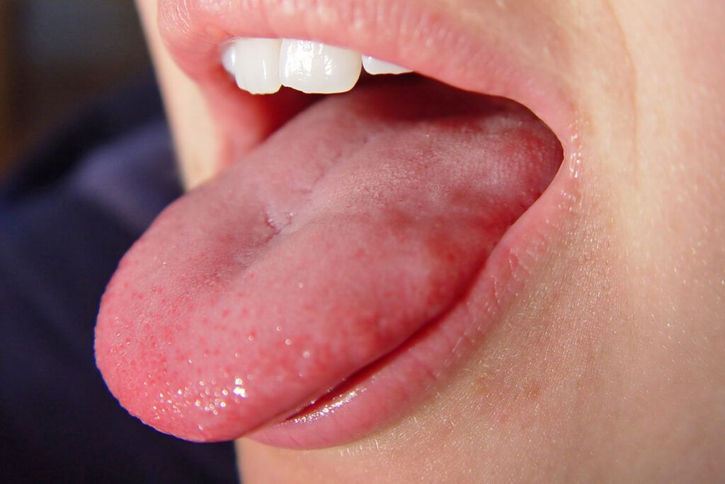 Tongue