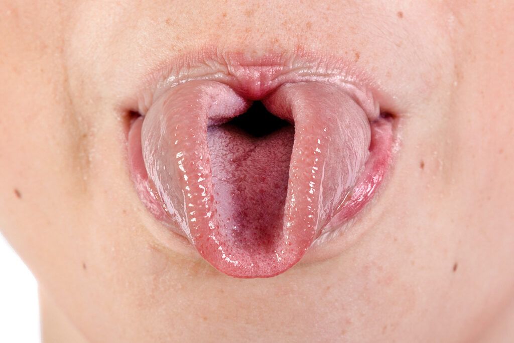 Curled tongue